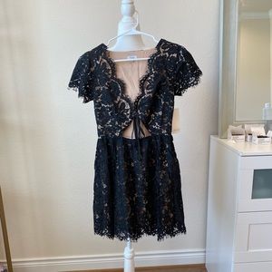 Tobi-Black lace dress. Size XS. NWT.